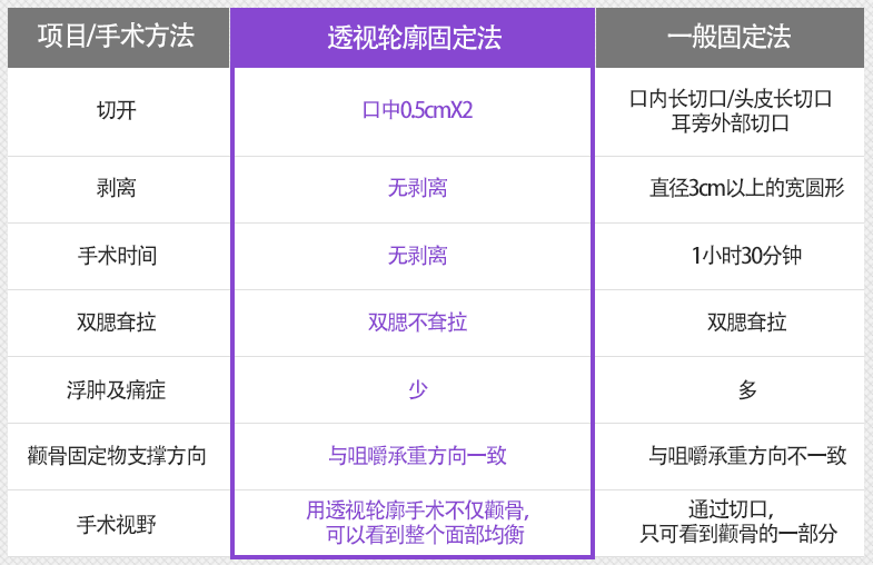 투시윤곽수술로 광대뼈는 물론 얼굴의 전체적인 균형까지 확인 가능