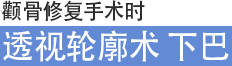 관골(광대뼈) 재수술시 투시윤곽술 턱