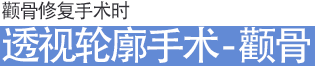 관골(광대뼈) 재수술시 투시윤곽술 광대