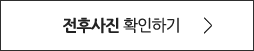 전후사진 확인하기
