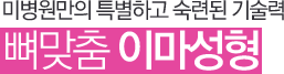 미병원만의 특별하고 숙련된 기술력 뼈맞춤 이마성형