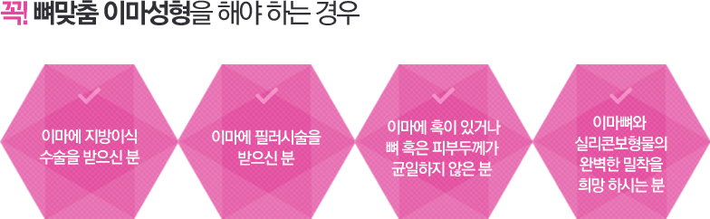 꼭! 뼈맞춤 이마성형을 해야 하는 경우 - 이마에 지방이식 수술을 받으신 분, 이마에 필러시술을 받으신 분, 이마에 혹이 있거나 뼈 혹은 피부두께가 균일하지 않은 분, 이마뼈와 실리콘보형물의 완벽한 밀착을 희망 하시는 분