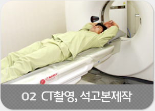 02- CT촬영, 석고본제작
