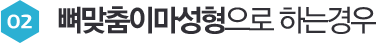 02 뼈맞춤이마성형으로 하는경우