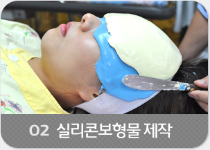 실리콘보형물 제작
